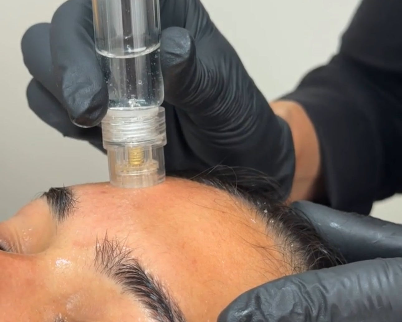 Peptide Gold Infusiuon