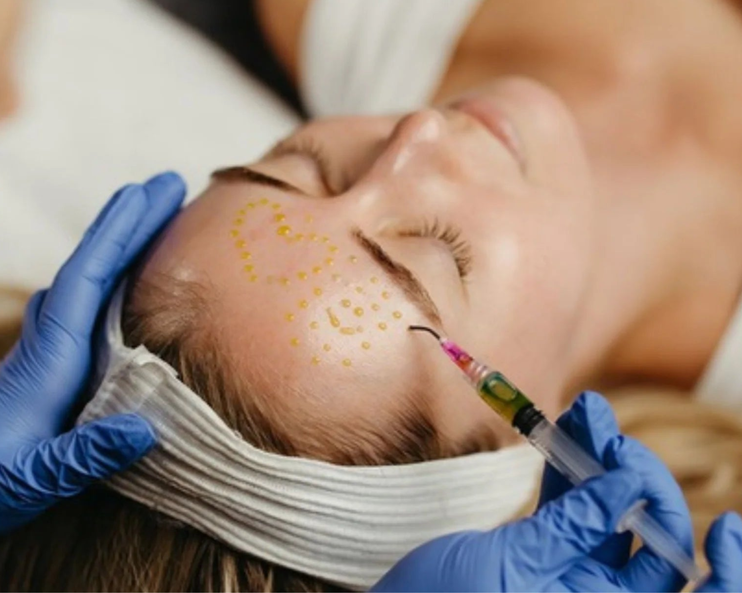 Bio Re Peel: Next Generation of Skin Rejuvenation