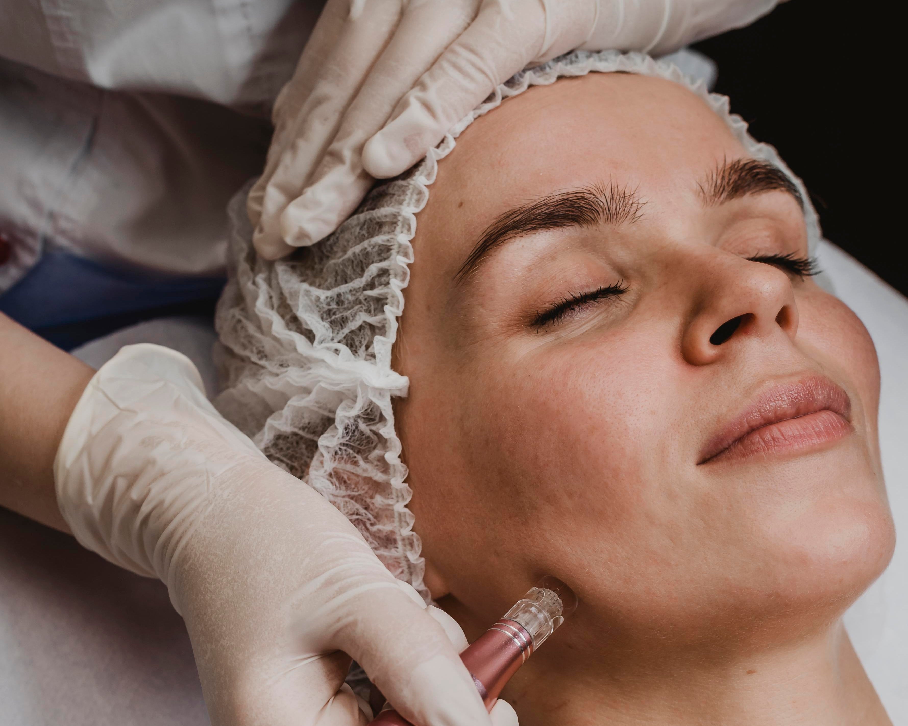 Skin Needling - Collagen Induction Therapy