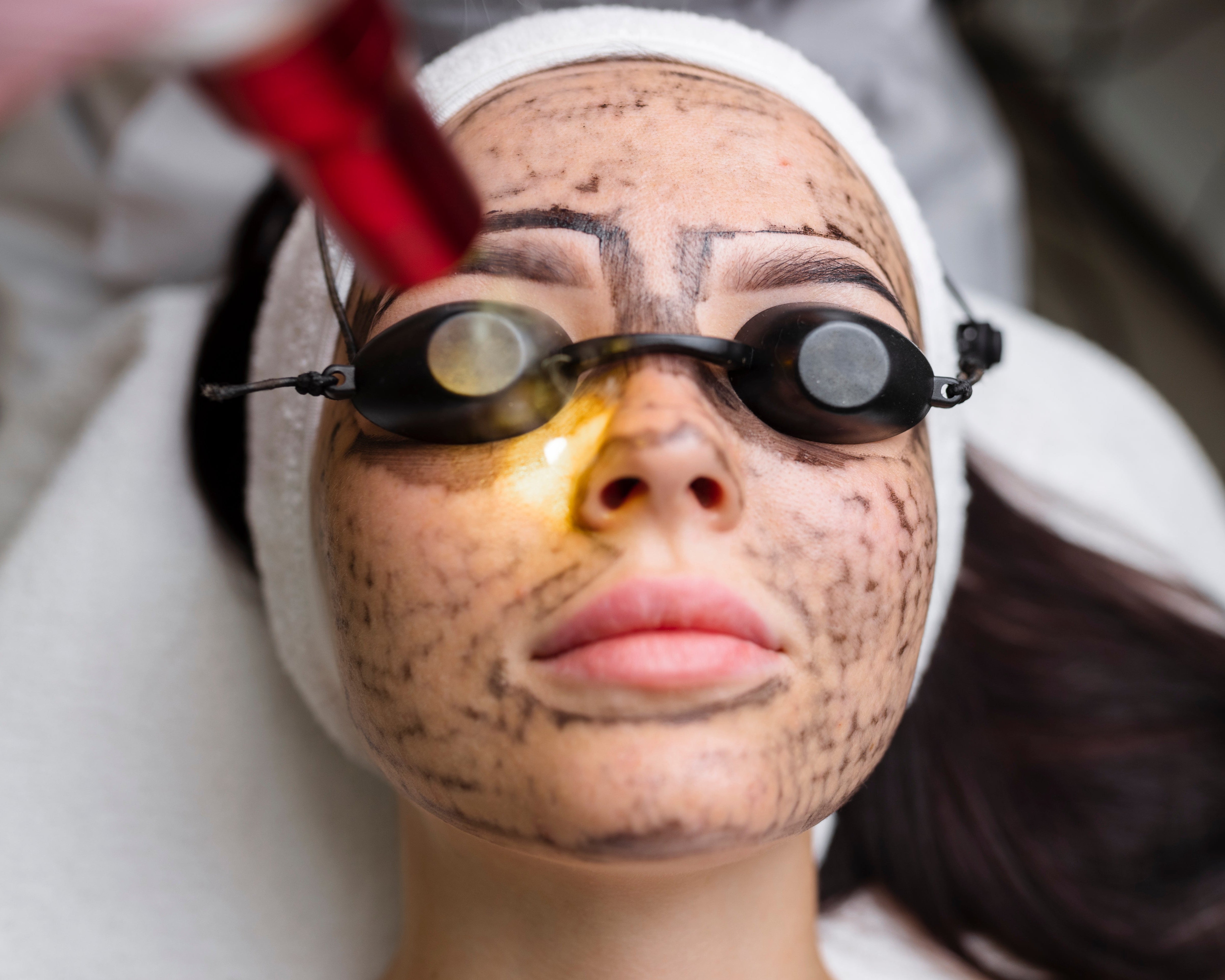Carbon Facial