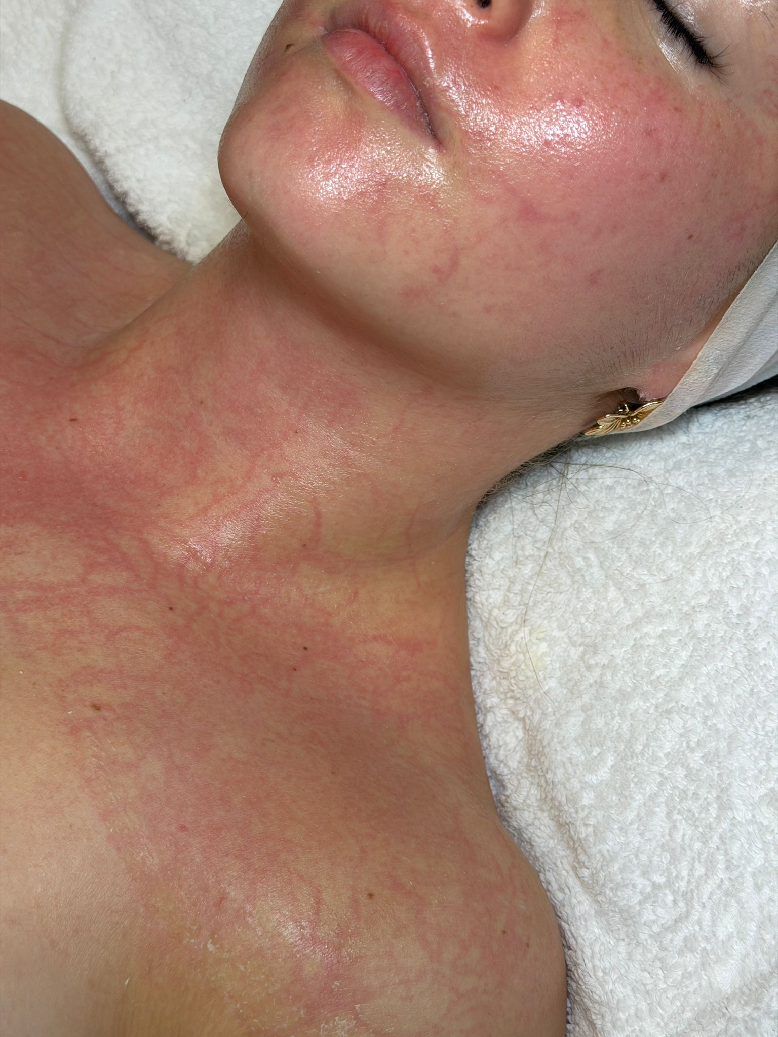 DMK Enzyme Treatment