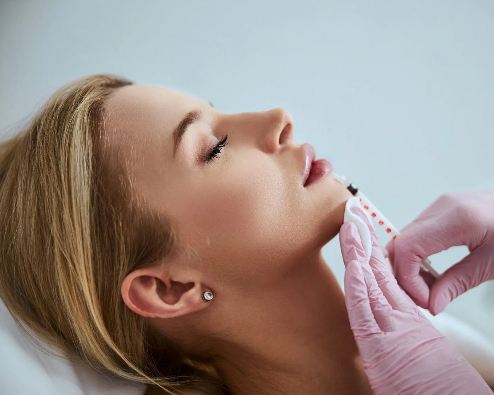Dermal Fillers